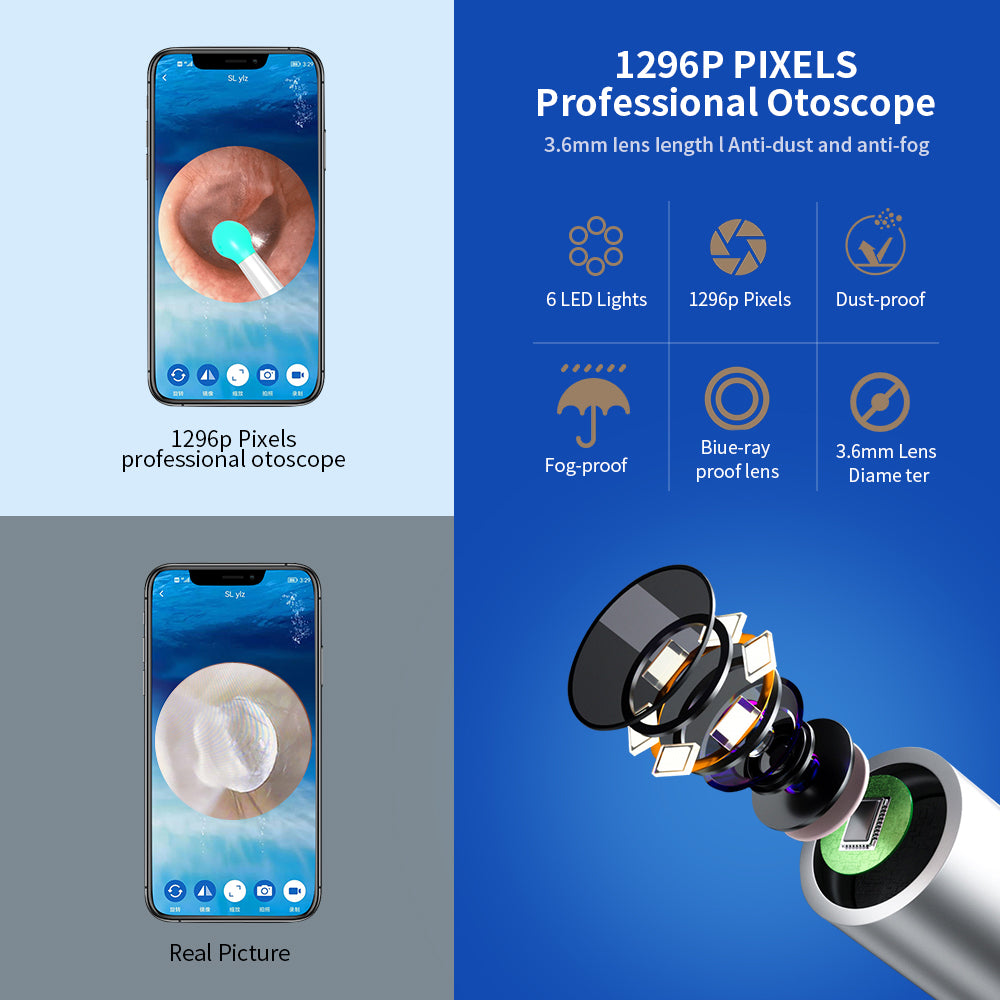 Ear Cleaner Otoscope with Camera